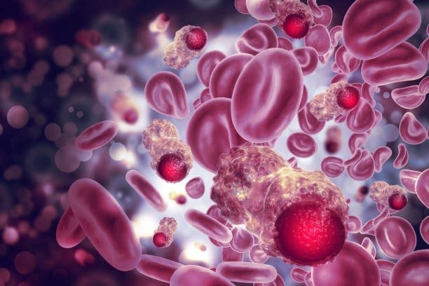 Chimiothérapie : une arnaque mortelle ?
